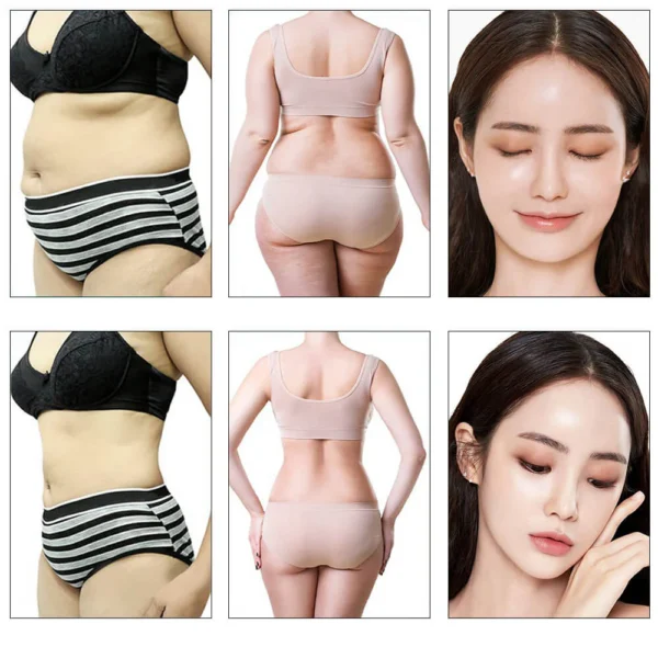 9-in-1 Cavitation RF EMS Body Sculpting Machine